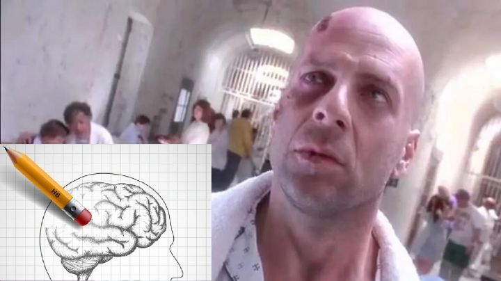 Bruce Willis padece demencia frontotemporal; entérate qué es esta enfermedad