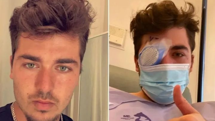 Hombre pierde su ojo tras dormir una siesta; el culpable fue un parásito | VIDEO