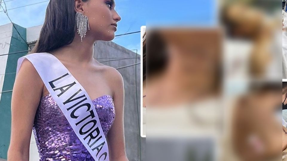 Mya saldaña fue atacada por su novio de una manera brutal.