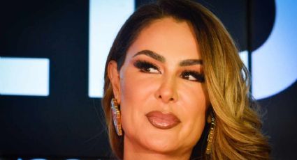 ¿Qué le pasó a Ninel Conde en el rostro?; fans están preocupados