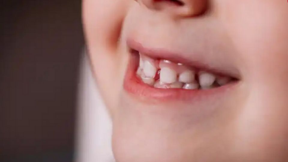 Los dientes de leche tienen propiedades de mucha ayuda en la vida