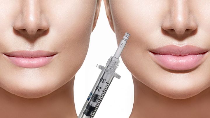 ¿Quién puso de moda los labios gruesos? Ácido hialurónico vive momento de gloria
