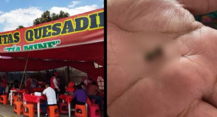 Va a comer barbacoa y se rompe un diente con un peligroso objeto en la comida