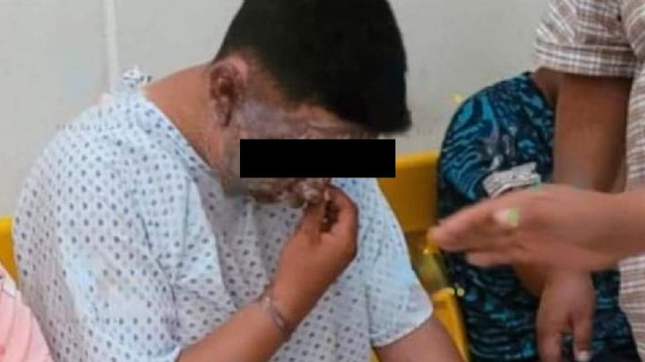 Capturan al piloto del globo aerostático que se incendió y causó dos muertes