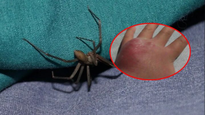 Araña violinista pica a niño en Reynosa; jugaba bajo la cama