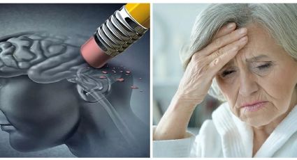 Alzheimer: la muerte silenciosa; por estos motivos podrías padecerla en el futuro