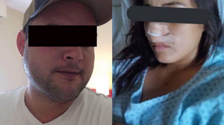 Hombre que le arrancó la nariz a Jazmín la ataca de nuevo y mata a su novio