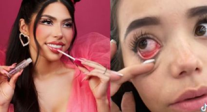 Joven denuncia que maquillaje de Yeri Mua le causa alergia; influencer responde