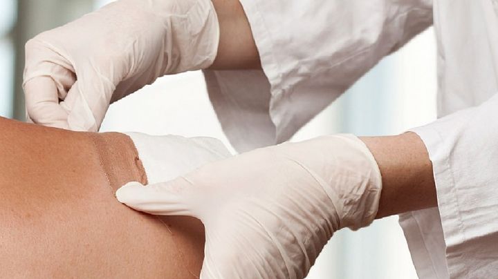 ¿Cómo debes cuidar las heridas de las cirugías durante el intenso calor de verano?