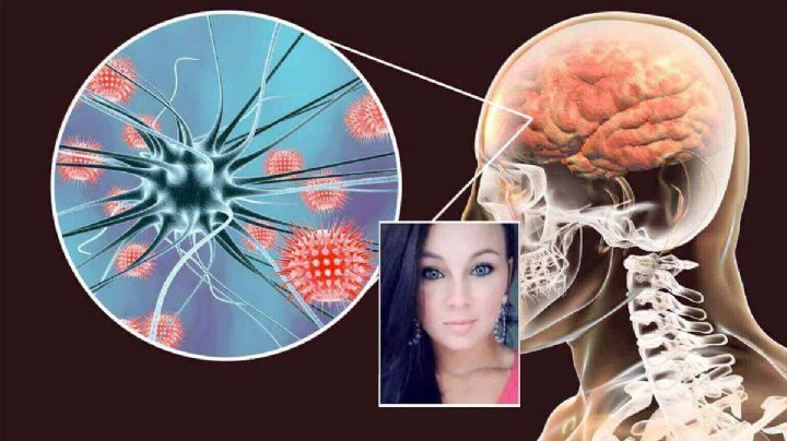 Muere joven de meningitis, cruzó a Matamoros a una cirugía estética