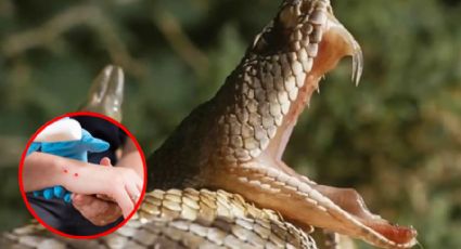 Esto tienes que hacer si te muerde una serpiente venenosa