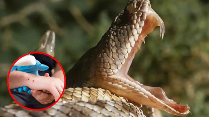 Esto tienes que hacer si te muerde una serpiente venenosa