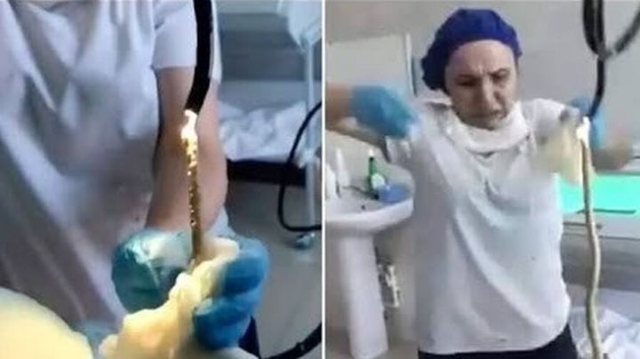 Mujer va al hospital luego de que una serpiente se desliza por su garganta | VIDEO