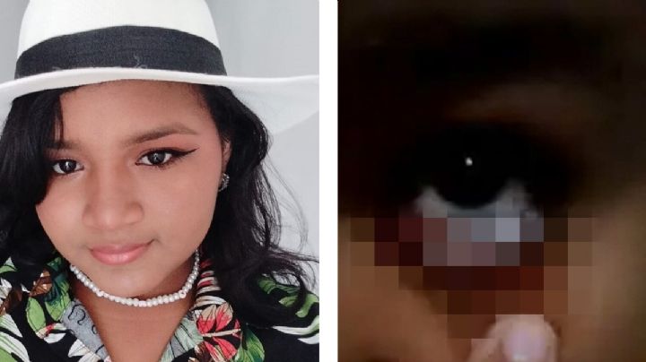 Adolescente llora lágrimas de sangre; la joven padece esa condición desde la pandemia de covid