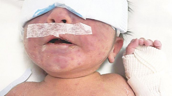 Requieren ayuda para Samuelito, recién nacido que está en cuidados intensivos