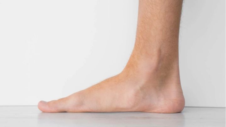 ¿Se puede corregir el pie plano?; te decimos algunos métodos