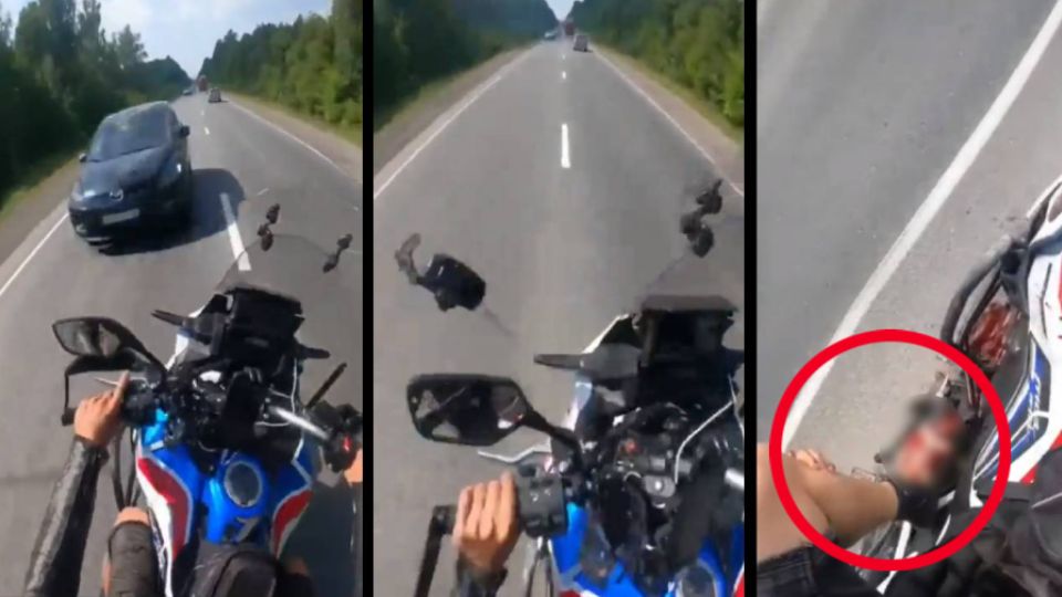 La imprudencia al conducir casi le cuesta la vida a este motociclista, quien lamentablemente perdió una parte importante de su cuerpo