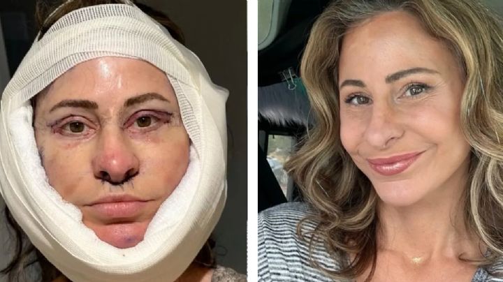 Vende su casa para pagarse una cirugía plástica; luce 20 años más joven, pero busca donde vivir