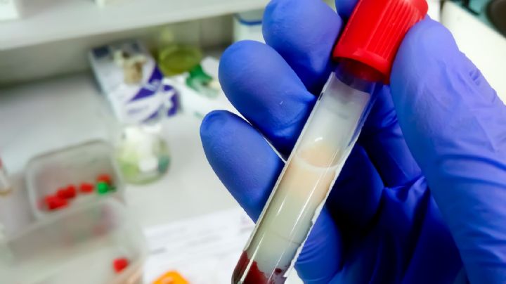 ¿Cómo bajar los triglicéridos?; aquí te decimos qué alimentos comer y cuáles evitar