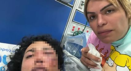 Paolita Suárez de 'Las Perdidas' alarma a sus fans; presuntamente fue golpeada por su prometido