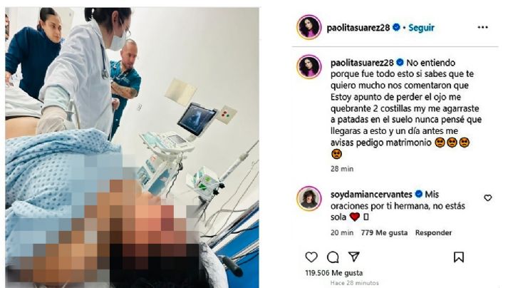'Estoy a punto de perder un ojo, me pateaste; un día antes me pediste matrimonio': Paolita Suárez