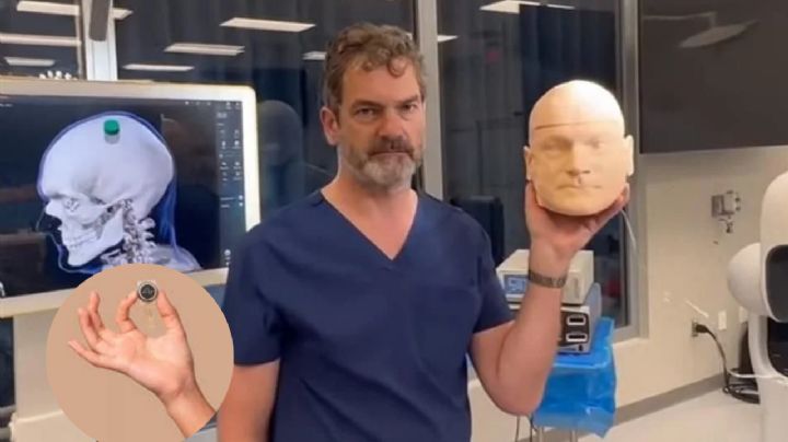 Chip de Neuralink ya fue implantado en un cerebro humano; afirma Elon Musk