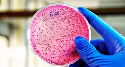 ¿La bacteria E. coli puede llegar a ser mortal?