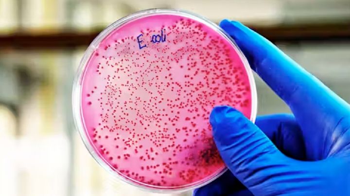 ¿La bacteria E. coli puede llegar a ser mortal?