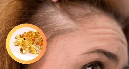 Descubre la vitamina clave que previene la alopecia y fortalece tu cabello