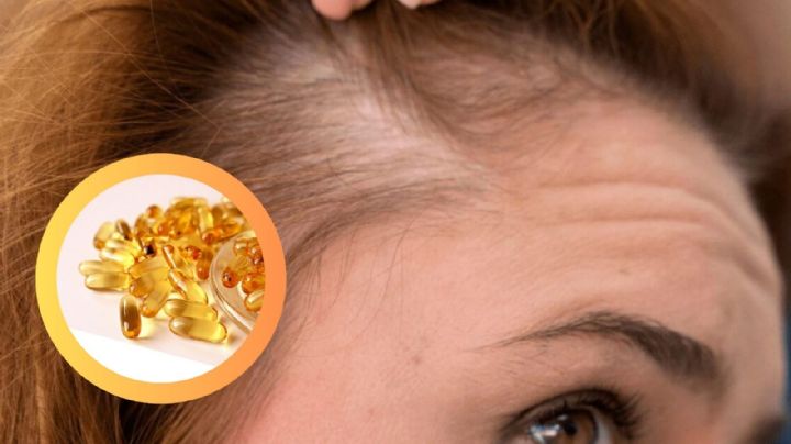 Descubre la vitamina clave que previene la alopecia y fortalece tu cabello