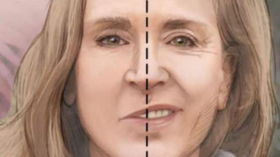 El nervio facial, también conocido como séptimo par craneal, es el que lleva señales del cerebro a los músculos de la cara, y el afectado en esta condición médica