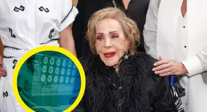 Silvia Pinal es hospitalizada de urgencia; este es su estado de salud