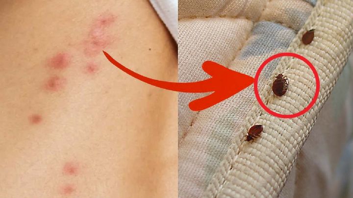 Razón para aprovechar el invierno y eliminar las chinches en casa