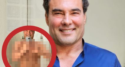 'Mis patas de pollo': Eduardo Yáñez recibe insultos tras mostrarse en bikini | FOTO