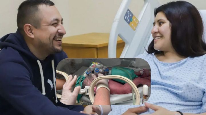 Separarán a las siamesas nacidas en el estado de Nuevo León