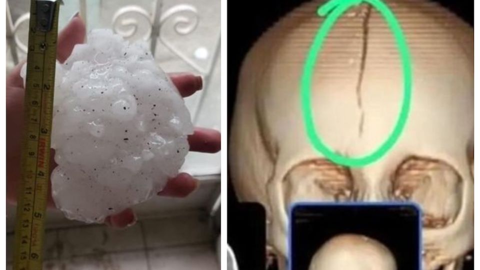 Granizo fractura cabeza de niña en Sabinas, Coahuila.