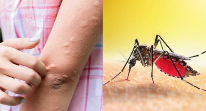 Evita las picaduras de mosquitos con estos remedios hechos en casa