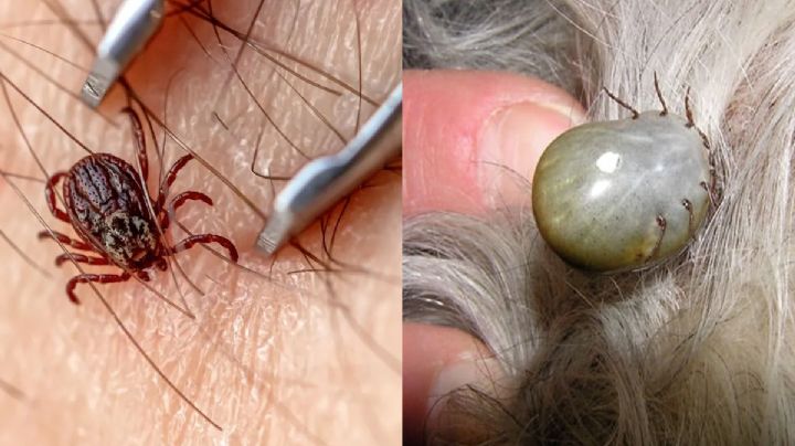 Temporada de garrapatas: estas son las enfermedades que pueden transmitir 