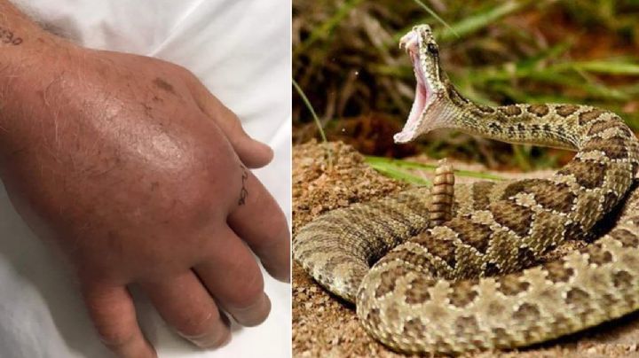 Si una víbora venenosa muerde a una persona, ¿cuánto tiempo se tiene para ir al hospital?