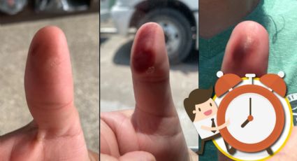Elecciones 2024: ¿cuánto tiempo tarda en quitarse la tinta del dedo pulgar después de votar?