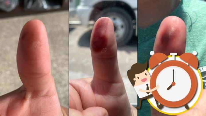 Elecciones 2024: ¿cuánto tiempo tarda en quitarse la tinta del dedo pulgar después de votar?