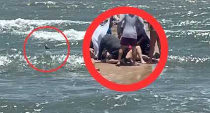 Tiburón ataca gravemente a mujer en playa de la Isla del Padre | FUERTES IMÁGENES