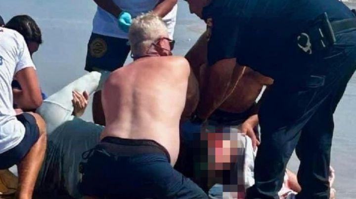 MOMENTO EXACTO del rescate de la mujer mordida por un tiburón en la Isla del Padre | VIDEO