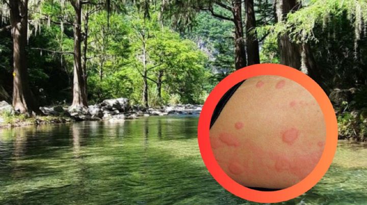 Alergias tras nadar en el Río Ramos: descubre la posible causa