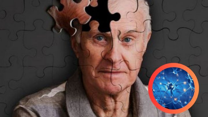 ¿Puedes evitar el Alzheimer?, descubre los secretos para reducir el riesgo
