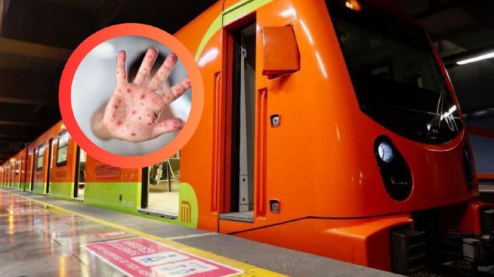 MPOX: Estas son las precauciones que debes tomar en cuenta al usar transporte público