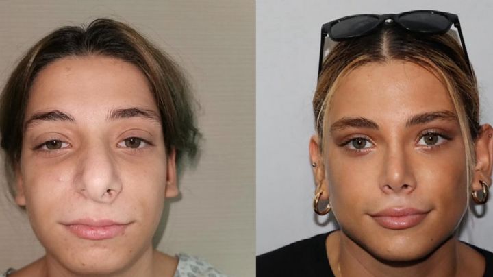 Clínica de Turquía impacta a las redes por los sorprendentes cambios de sus clientes | FOTOS