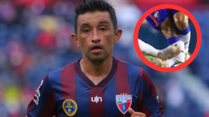 Momento Exacto en el que sufre fractura de tibia 'Hobbit' Bermúdez | VIDEO