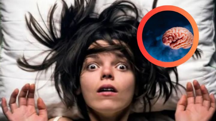 ¿Qué es el síndrome de la cabeza explosiva?; es más común de lo que piensas