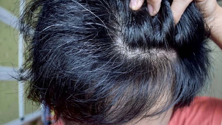 Canas en niños: razones por las que salen cabellos blancos a temprana edad 